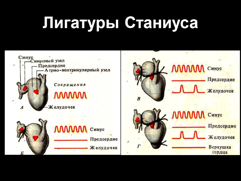 Лигатуры Станиуса